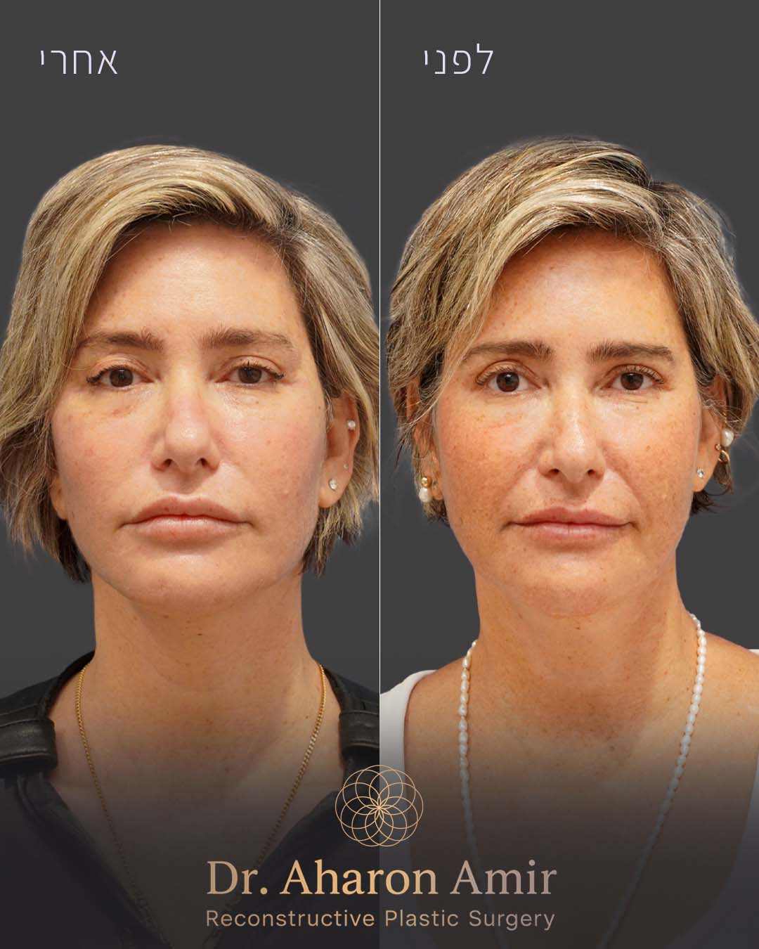 before-after-01