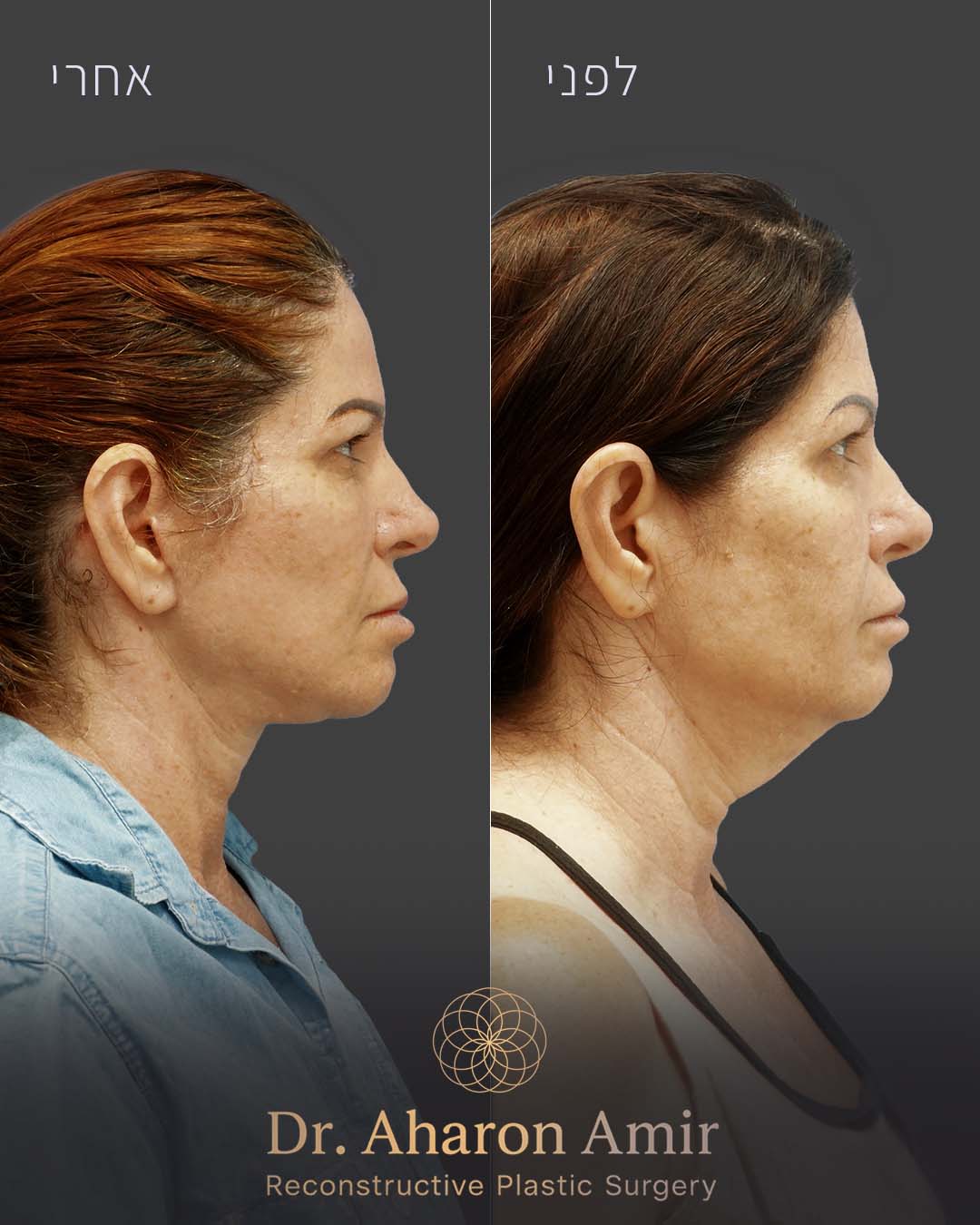before-after-07