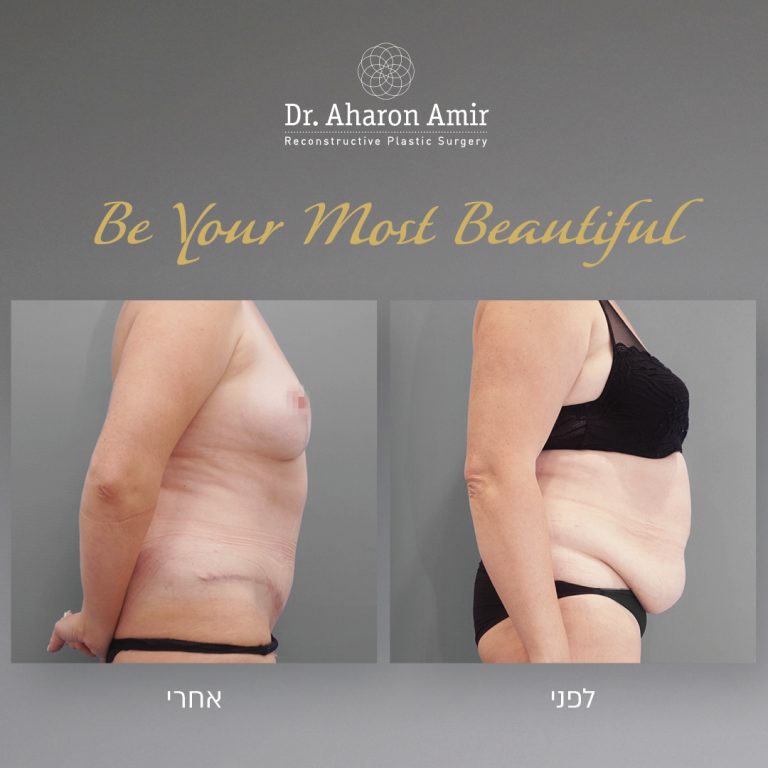 חופשת קיץ במרפאה