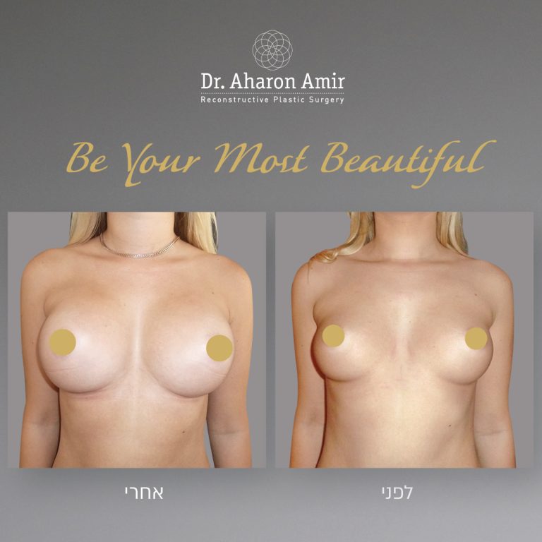 breast_enlargement_1080