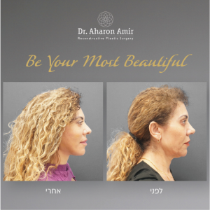 dr aharon amir-14
