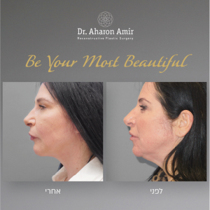 dr aharon amir-16