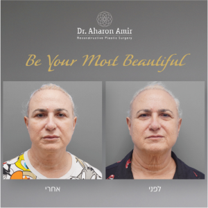 dr aharon amir-17